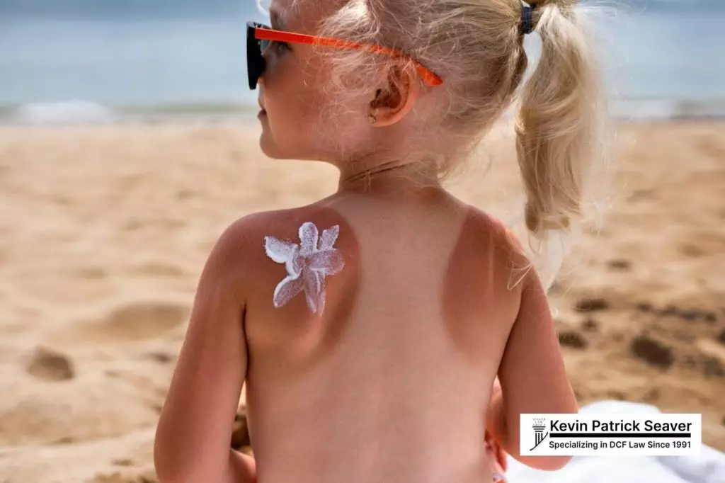 Understanding MA DCF Investigation for Sunburn 3 How a Sunburn Leads to a MA DCF Investigation